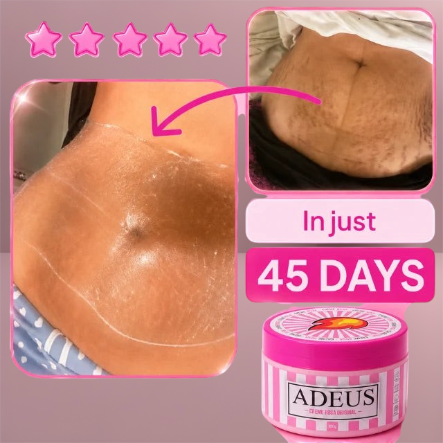 Crema corporal de tratamiento intensivo Vizcanova en tarro rosa, mostrando resultados de mejora en la piel del abdomen.